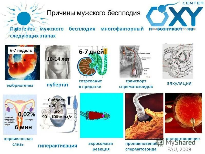 Этиология мужского бесплодия. Мужское бесплодие патогенез. Причины мужского бесплодия. Причины мужского бесплодия симптомы. Бесплодие у мужчин причины