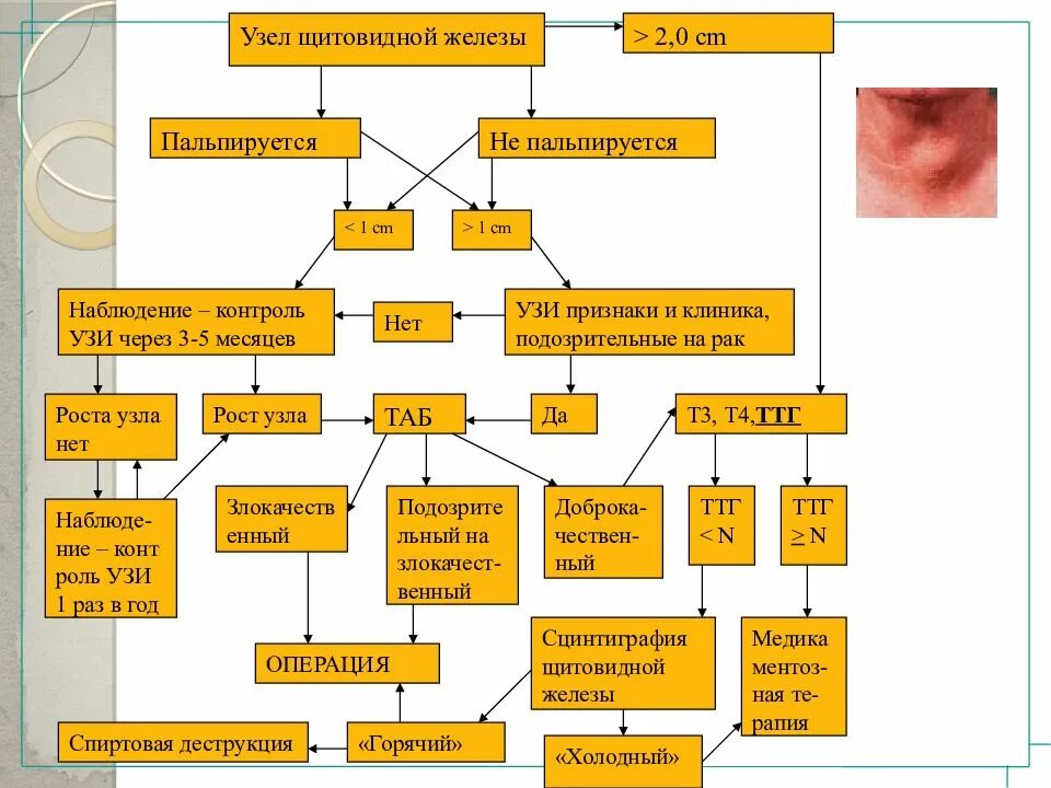 Могут ли узлы щитовидной железы рассосаться. Объем узла щитовидной железы. Узел на щитовидной железы допустимо. Узлы в щитовидной железе Размеры.