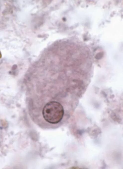 Entamoeba coli в кале. Цисты Entamoeba. Entamoeba histolytica микроскопия. Entamoeba histolytica под микроскопом. Coli дизентерийная амеба.