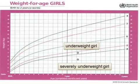 Weight for age