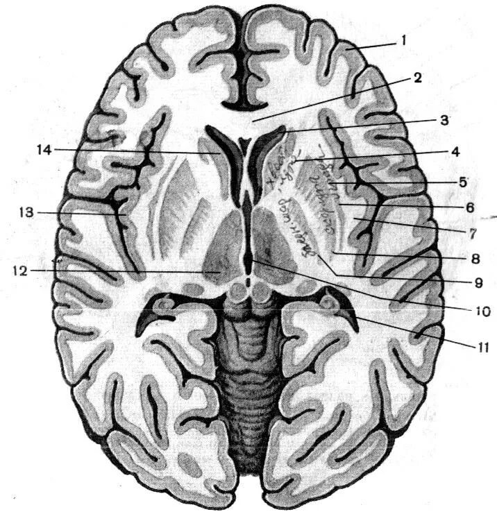 Ядра полушарий большого мозга. Горизонтальный срез головного мозга базальные ядра. Базальные ядра головного мозга поперечный. Поперечный срез головного мозга анатомия. Базальные ядра головного мозга анатомия.