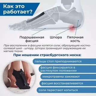 Страсбургский носок ортопедический