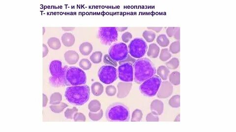 Периферическая т