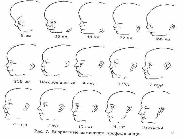 Варианты формы черепа. Форма черепа у новорожденного по месяцам. Меняется ли форма черепа с возрастом у детей. Меняется ли форма черепа с возрастом у новорожденных. Формы черепа человека в норме.