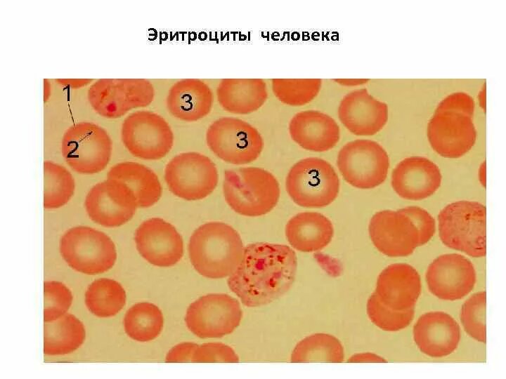 Клетки эритроцитов лягушки. Эритроциты человека. эритроциты крови человека. эритроциты лягушки. как выглядят эритроциты.