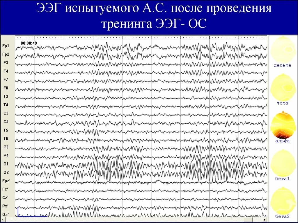 Для чего делают ээг