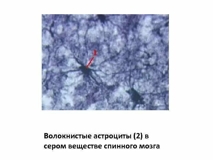 Астроциты мозга. Спинной мозг гистология препарат астроциты. Волокнистые астроциты. Протоплазматические и волокнистые астроциты. Астроциты в сером веществе.