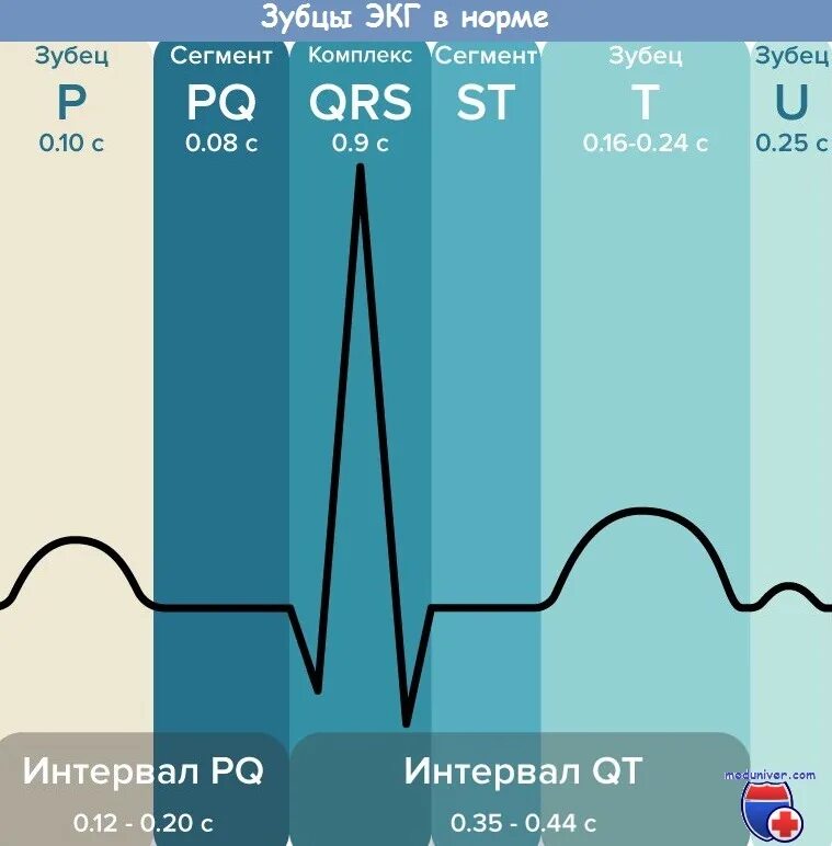 Электрокардиограмма с зубцами в норме. Зубцы и интервалы ЭКГ нормы. QRS норма ЭКГ. ЭКГ зубцы. Зубцы экг в норме