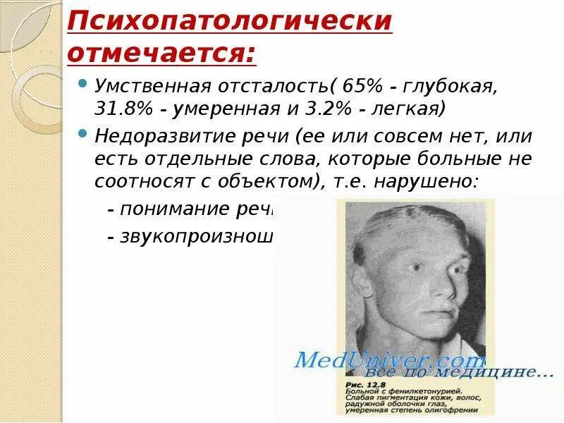 Умеренная легкая умственная отсталость. Легкая умственная отсталость. Глубокая умственная отсталость. Умеренная умственная отсталость Имбецильность.