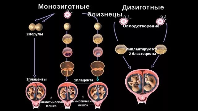Как получается двойня