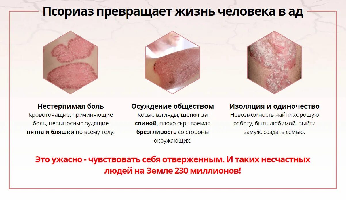 Названия кожных заболеваниях у взрослых. Названия кожных заболеваниях у взрослых
