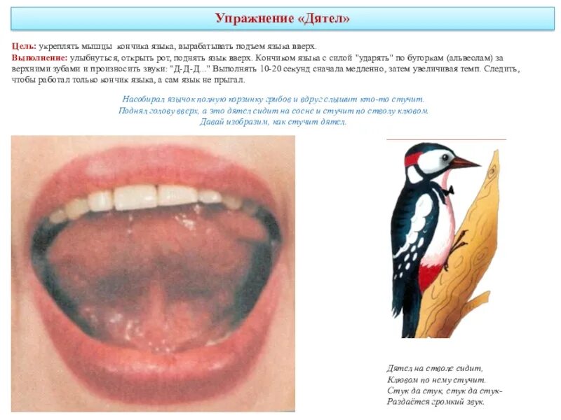 Язык и зубы звуки. Артикуляционная гимнастика дятел цель. Упражнение дятел артикуляционная гимнастика. Дятел упражнение для языка логопедия. Артикуляционная гимнастика для детей дятел.