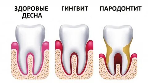 Болит здоровый зуб
