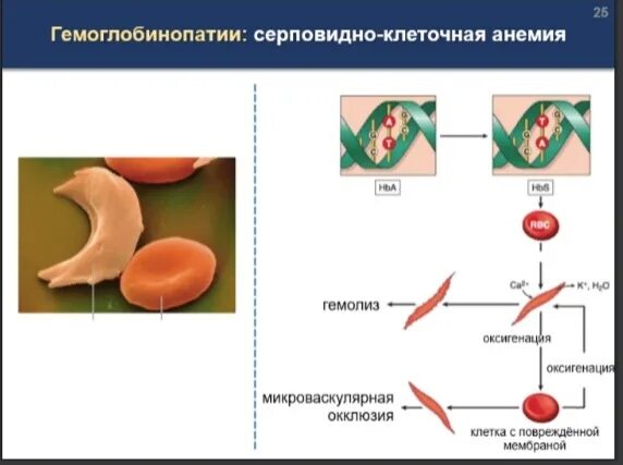 Гемоглобин серповидноклеточная анемия. Серповидноклеточная анемия тип наследования. серповидноклеточная анемия генная мутация. причина серповидноклеточной анемии мутация в гене. серповидноклеточная анемия результат точковой мутации.