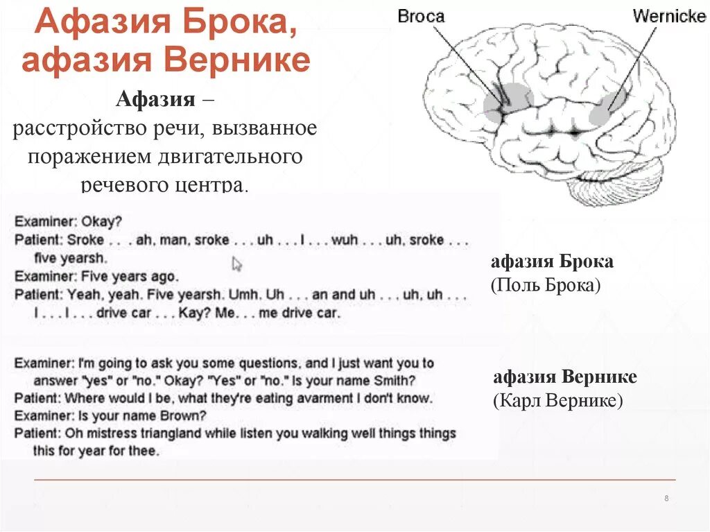 Центр афазии. Сенсорная корковая афазия брока-вернике. зона брока афазия. афазия брока и афазия вернике. центр вернике сенсорная афазия.