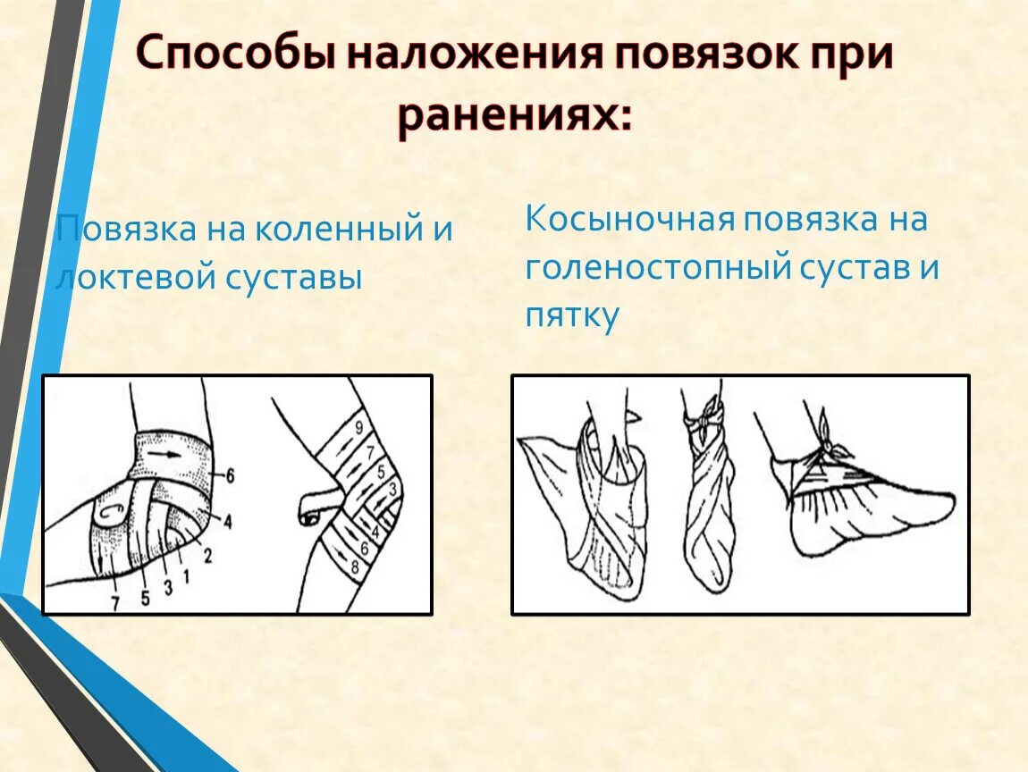 Какая повязка накладывается при повреждении голеностопного сустава. Способы наложения повязок. Способы наложения повязок при ранениях. Наложение повязки при ранении. Наложение повязки на конечность алгоритм.