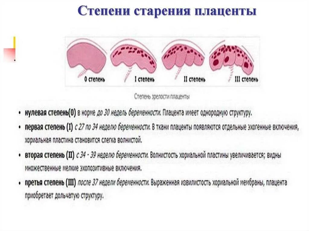 Старение плаценты в 32 недели беременности. Степень зрелости 2 при беременности. Степень зрелости плаценты на 32 неделе беременности. Старение плаценты на 32 неделе беременности 2 степень.