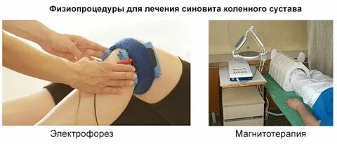 Электрофорез на коленный сустав