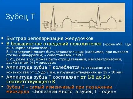 Зубец т на экг норма