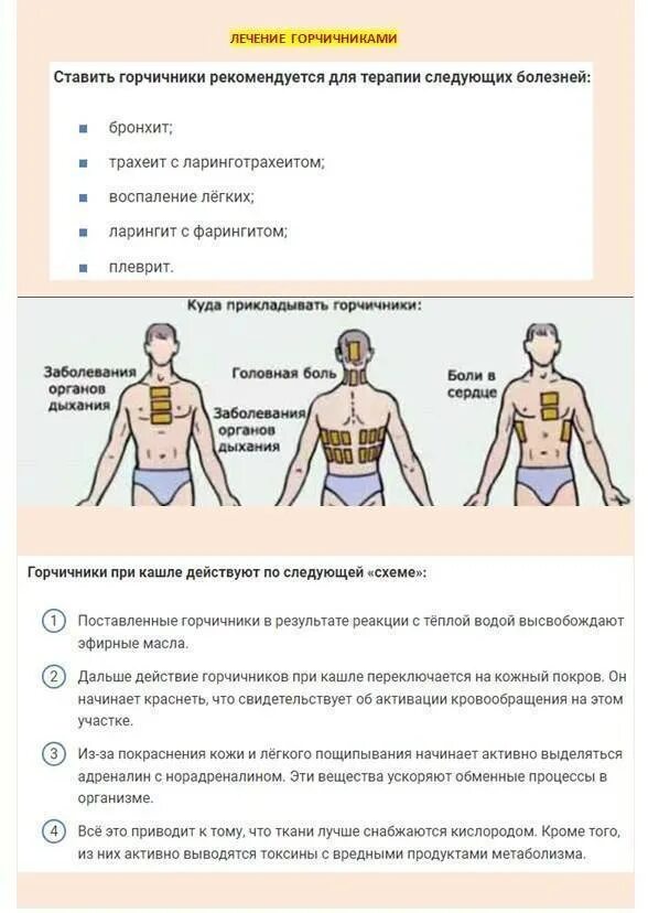 При какой температуре можно горчичники. Схема расположения горчичников при бронхите. как ставить горчичники при кашле. горчичники схема наложения. места постановки горчичников при бронхите.