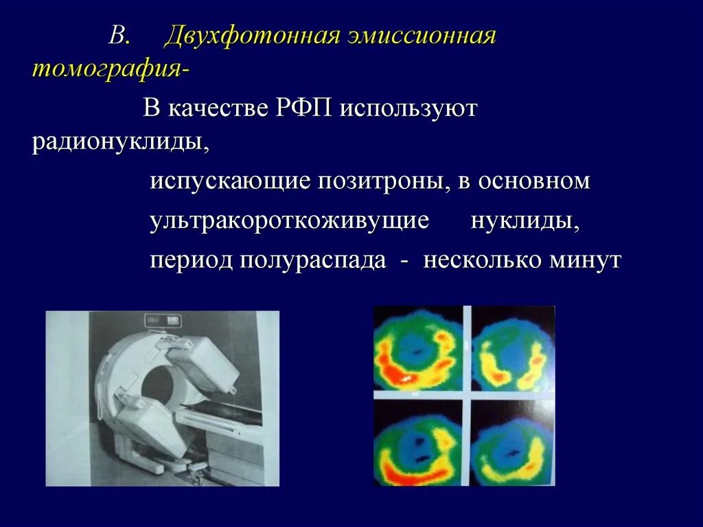 Что значит рфп в медицине онкологии