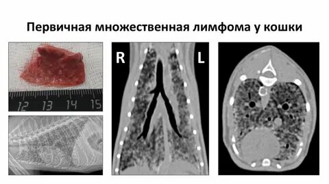 Эпителиотропная лимфома