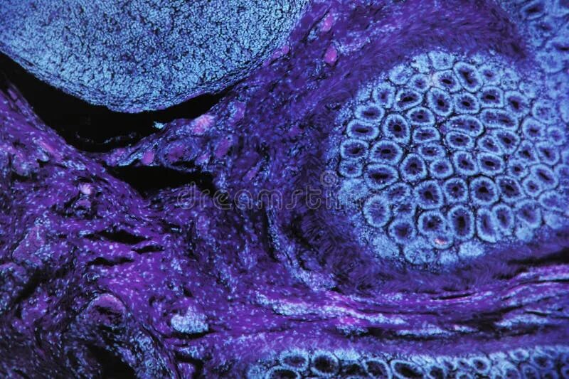 Фиолетовое лицо. Фиолетовое лицо. Красивые фиолетовые глаза. Фиолетовый болезнь. Фиолетовый болезнь.