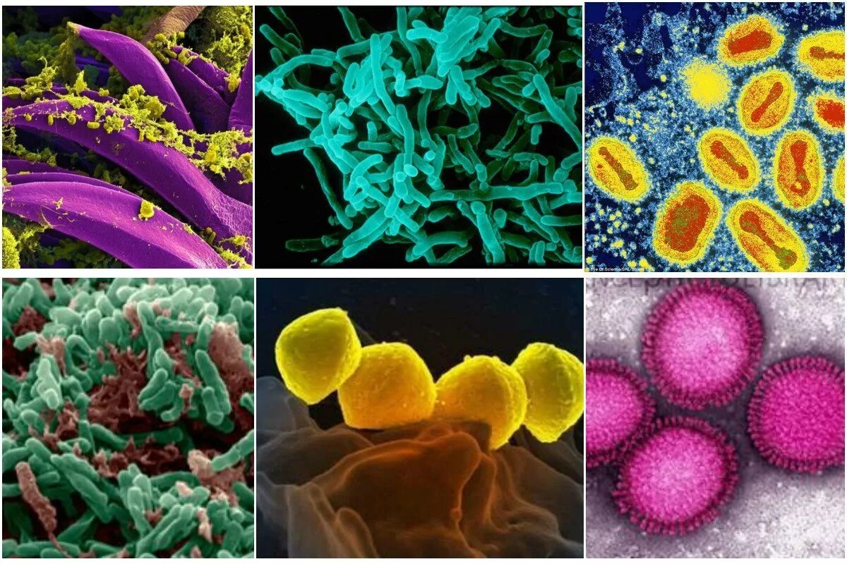 Болезнетворные бактерии животных. Патогенная бактерия сыпной тиф. Микробы возбудители инфекционных заболеваний. Микроорганизмы инфекция. Болезнетворные бактерии и вирусы.