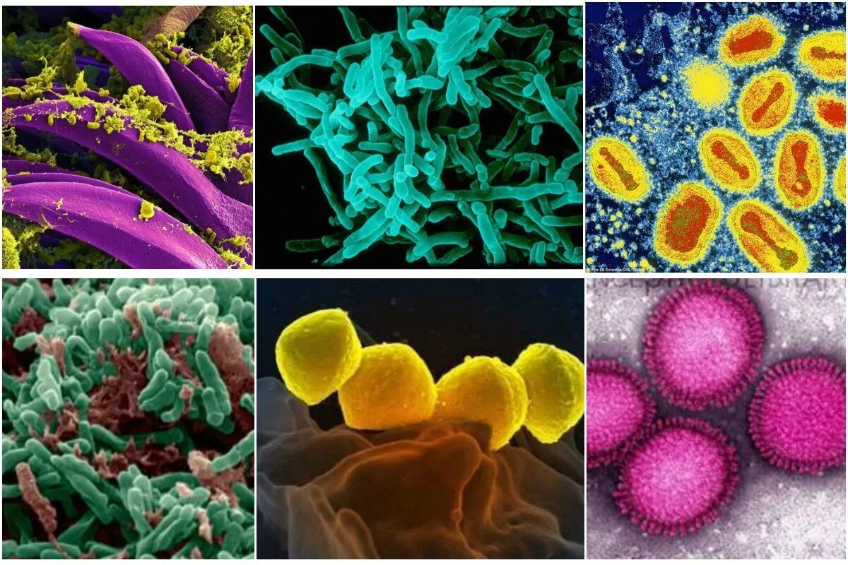 Заболевания вызванные различными бактериями. Патогенная бактерия сыпной тиф. Микробы возбудители инфекционных заболеваний. Микроорганизмы инфекция. Болезнетворные бактерии и вирусы.