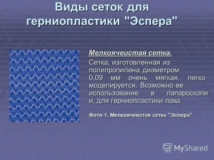 Типы сеток