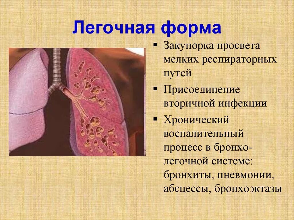 Легочный фиброз симптомы. Муковисцидоз легочная форма. муковисцидоз легочно кишечная форма. симптомы легочной формы муковисцидоза.