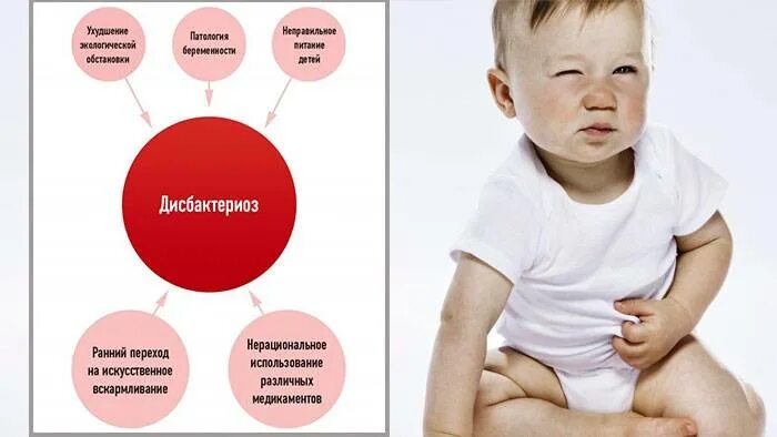 Дисбактериоз кишечника у новорожденных. Дисбактериоз у ребенка. дисбактериоз у малыша симптомы. дисбактериоз симптомы у ребенка до года. что такое дисбактериоз кишечника у детей до года.