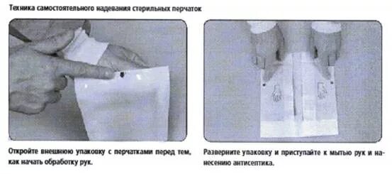 Мр использование медицинских перчаток. Схема одевания стерильных перчаток. техника надевания перчаток в медицине.