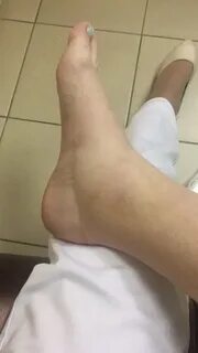 Убрать отеки во время