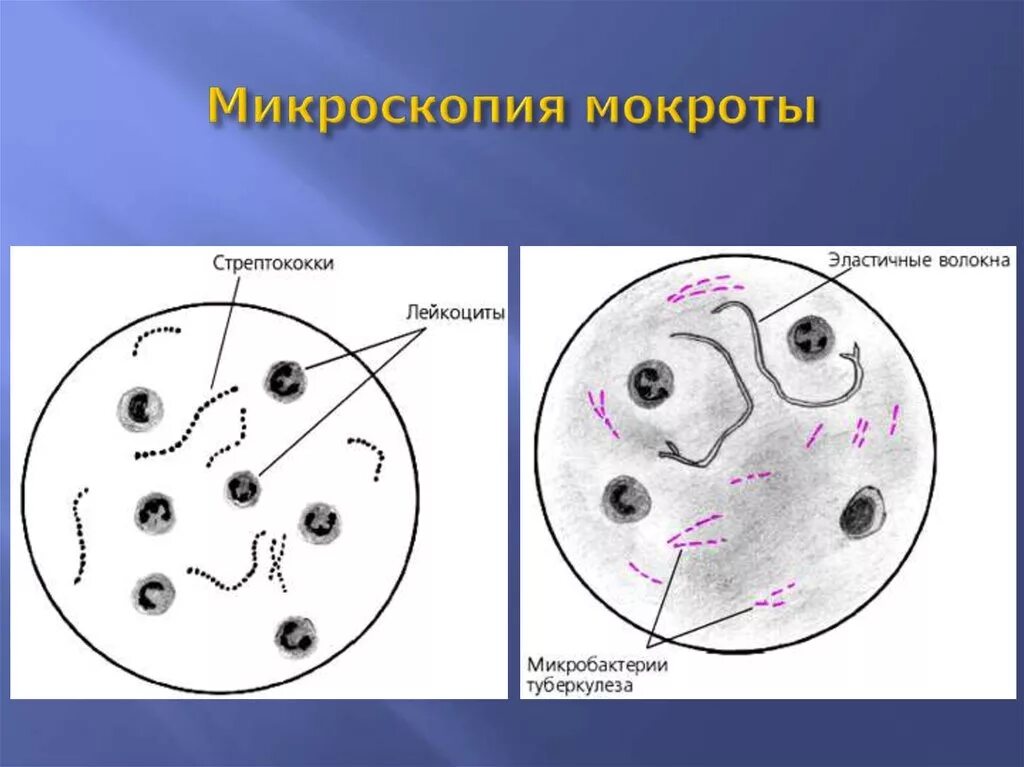 Микроскопическое мокроты