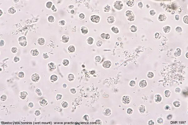 Простейшие в кале лечение. Blastocystis Hominis. Цисты blastocistis Hominis. Циста лямблии под микроскопом.