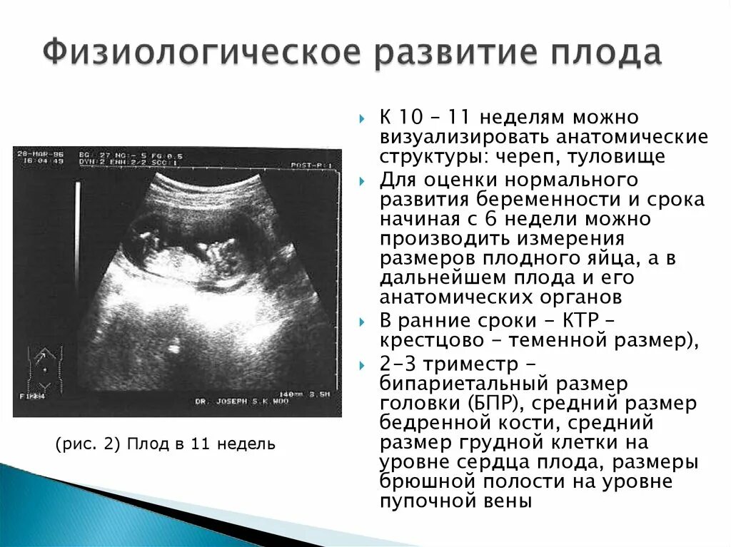 Размер эмбриона на 6 неделе. Срок 6 недель размер плода.