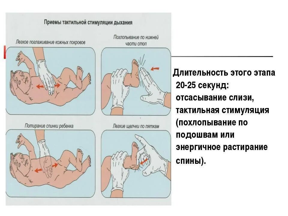 Первый этап реанимации при асфиксии новорожденного. Асфиксия новорожденных этапы оказания помощи. Длительность первого этапа реанимации при асфиксии новорожденного. Этапы оказания неотложной помощи при асфиксии у новорожденного. Первый этап реанимации новорожденного