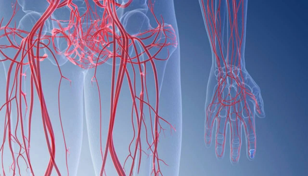 Как выглядят сосуды фото If you have an iliac artery stent graft, should you keep your pelvis fixed on th