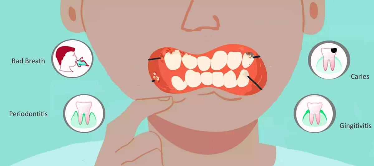 Tooth problems. Can the dentist recognize a tooth root inflammation?.