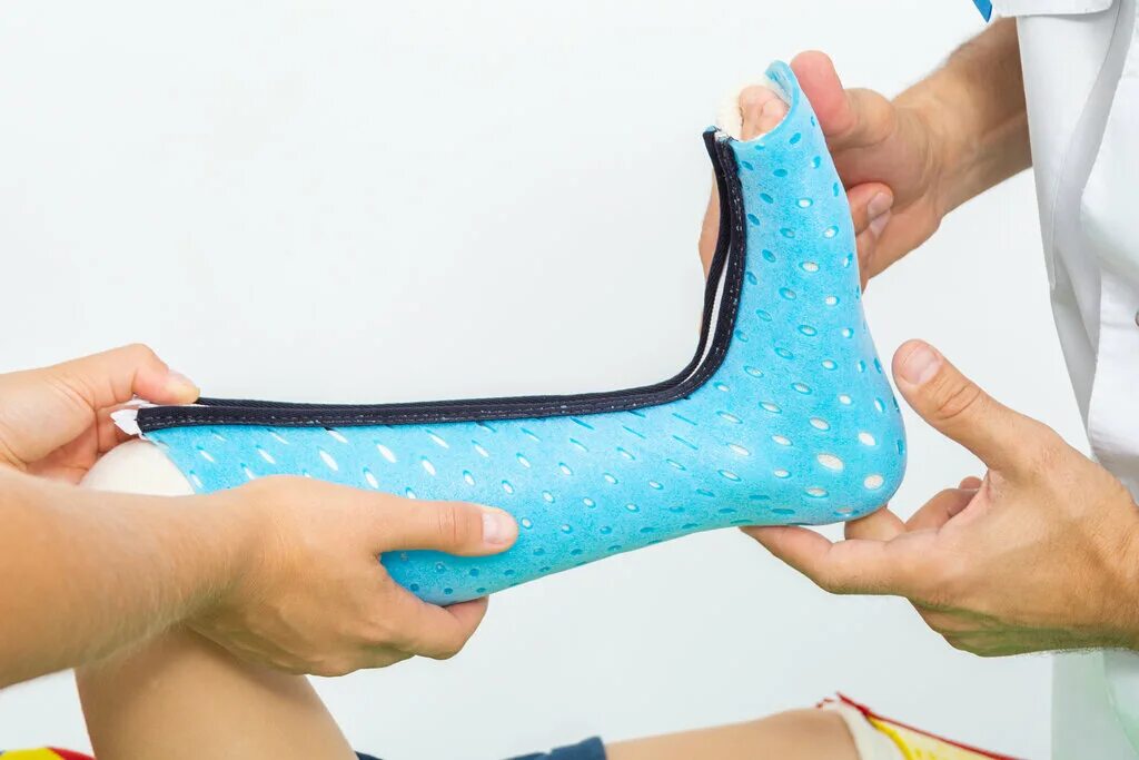 Ортез лучезапястный а. Изготовление индивидуальных ортезов. Ortex 021 ортез для запястья и руки. Ортез при дцп. 2083 uni ортез лучезапястный.