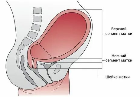 Разрыв матки: причины, симптомы и лечение в статье гинеколога Скрябнева Т. С.
