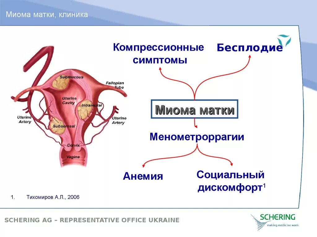Миоматозный узел матки как лечить Миома матки: лечение народными средствами без операции (отзывы и рецепты, которы