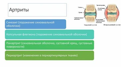 Синовит препараты