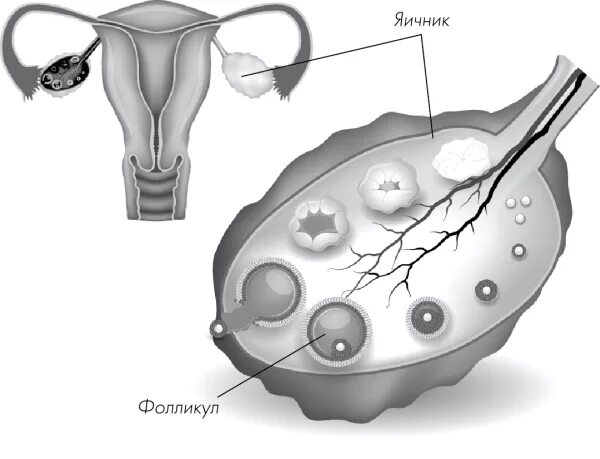 Яичники у женщин цена. Фолликулы в яичниках анатомия. Воспаление фолликул фолликул в яичнике. Везикулярный фолликул яичника. Строение фолликулов яичников.