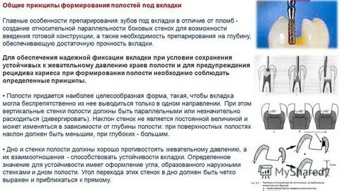 Полость правило