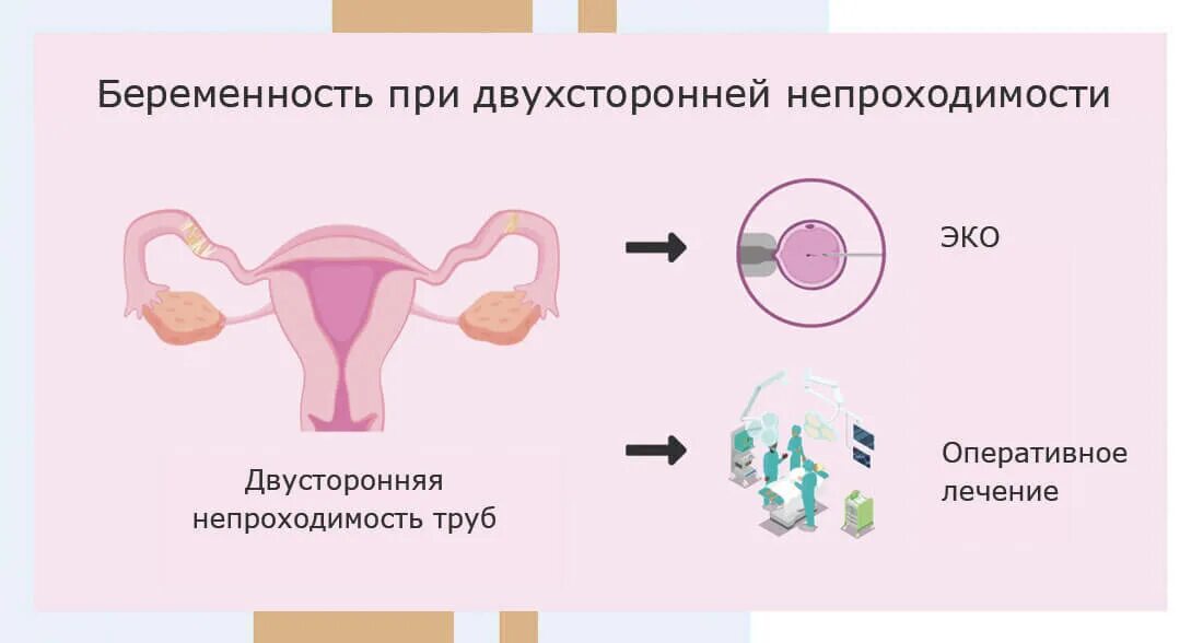 Перевязка маточных труб. Как перевязывают трубы у женщин. Яйцеклетка при перевязанных трубах.