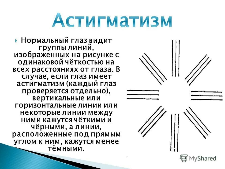 Что такое сложный миопический астигматизм. Сложный гиперметропический астигматизм 1 степени. Астег. Смешанный гиперметропический астигматизм. Тест на астигматизм.