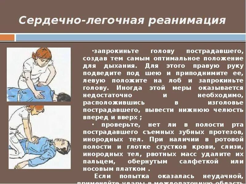 Тест до какого момента нужно откачивать пострадавшего. Сердечно-лёгочная реанимация. Сердеснолегочная реанимация. Сердечнолегочная реанимаци. Сердечно легочнаяреанимция.