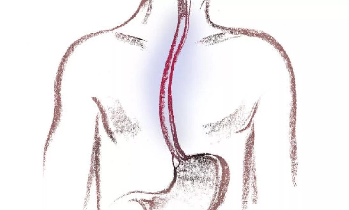 Пищевод отдает в спину. Эзофагит эзофагоскопия. Эзофаготонокимография пищевода. Пищевод рисунок. Пищевод без подписей.